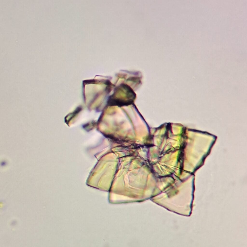 Uric Acid Crystals, Diamond/Rhomboid  & Rosette Form