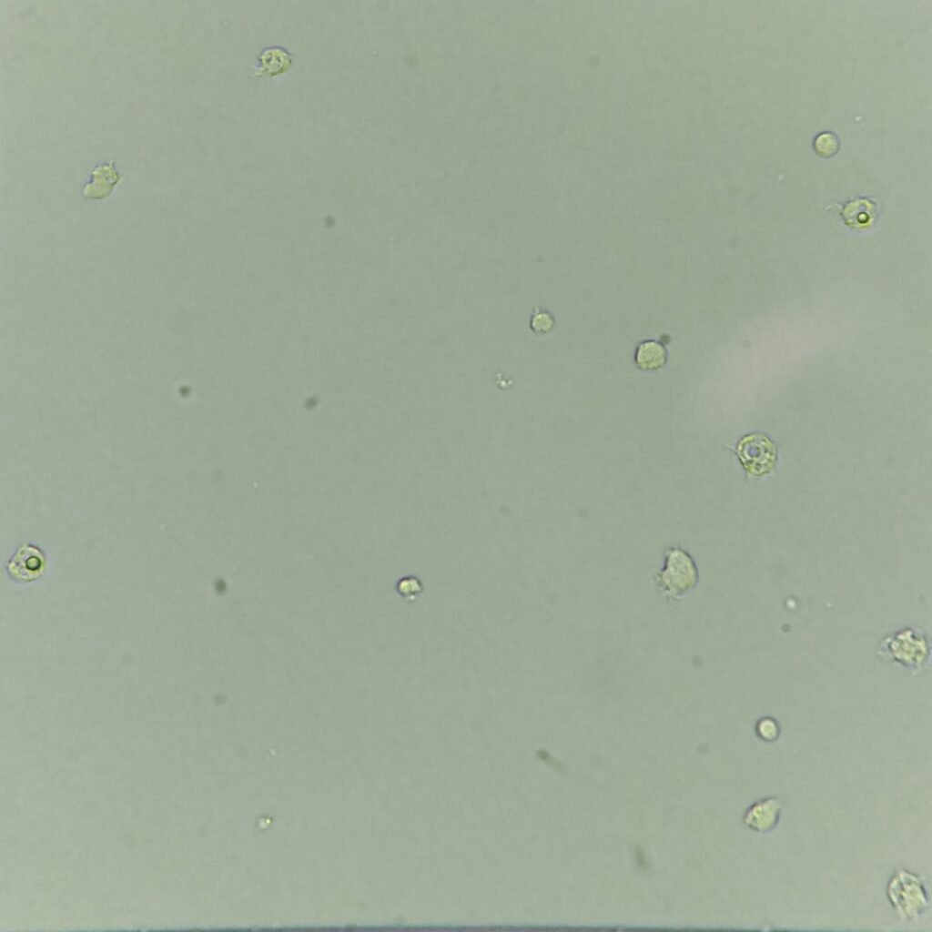 white blood cells in urine