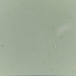 WBCs in Urine: Identification & Significance - MedLabBuddy
