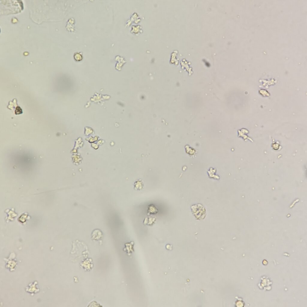 white blood cells in urine