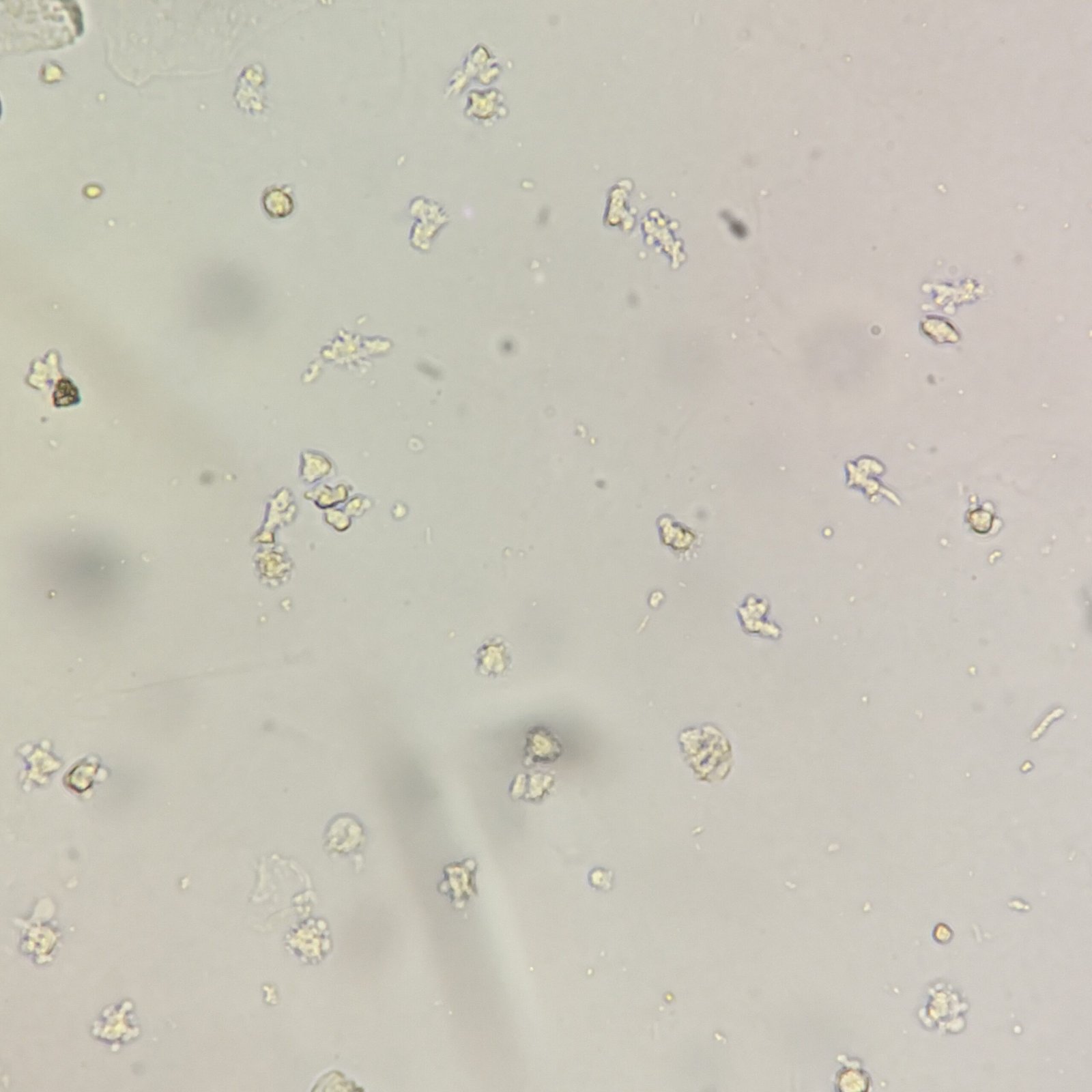 White blood cells in urine