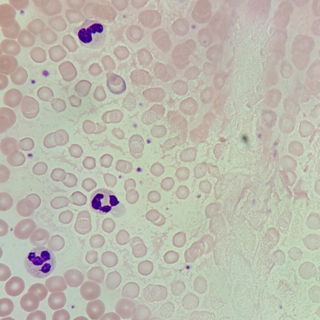 Water artifact on RBCs