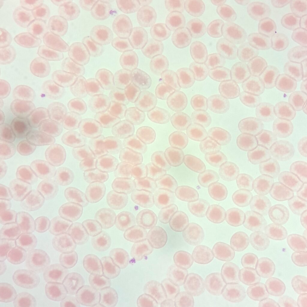 Water artifact on RBCs
