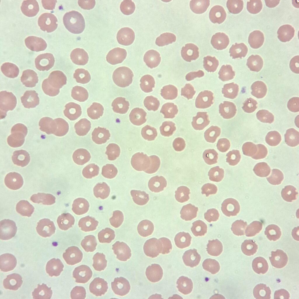 Water artifact on RBCs