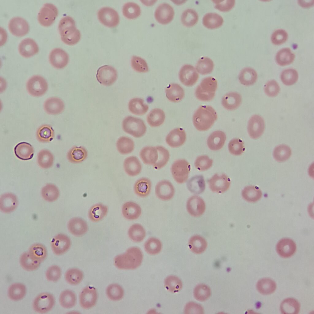 Water RBC artifact