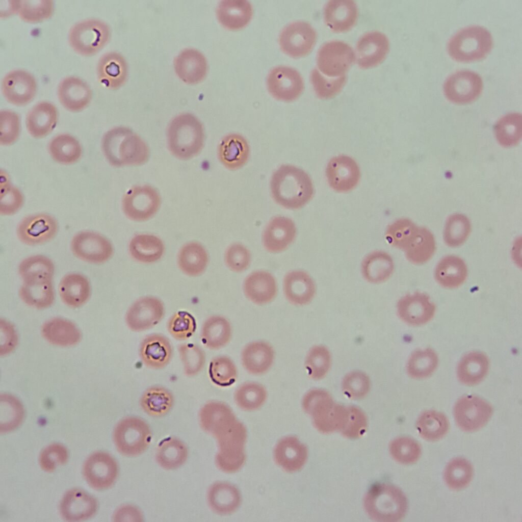 Water RBC artifact