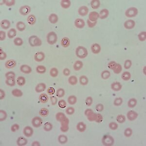 Cabot Rings - MedLabBuddy