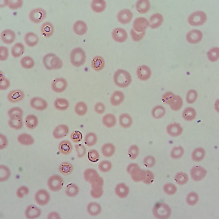 RBC Artifacts