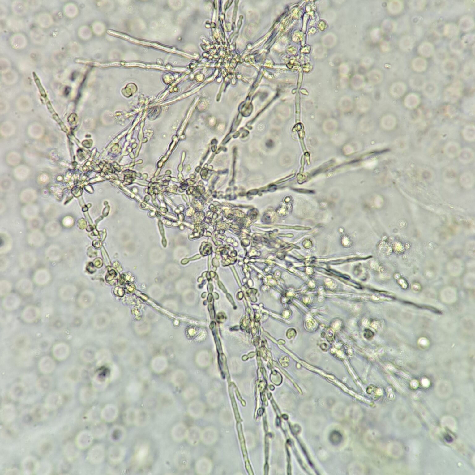 Hypea Yeast: Budding & Hyphae - MedLabBuddy